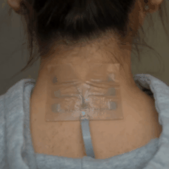 BandEI: flexible electrical impedance sensing bandage